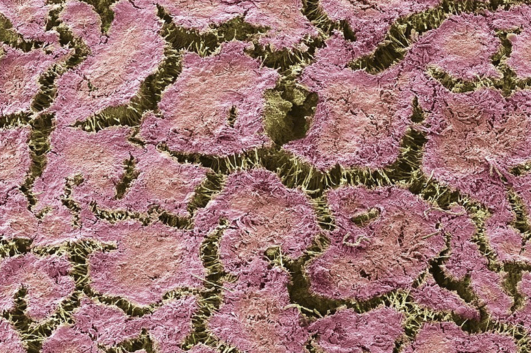 Бактерии Под Микроскопом Фото