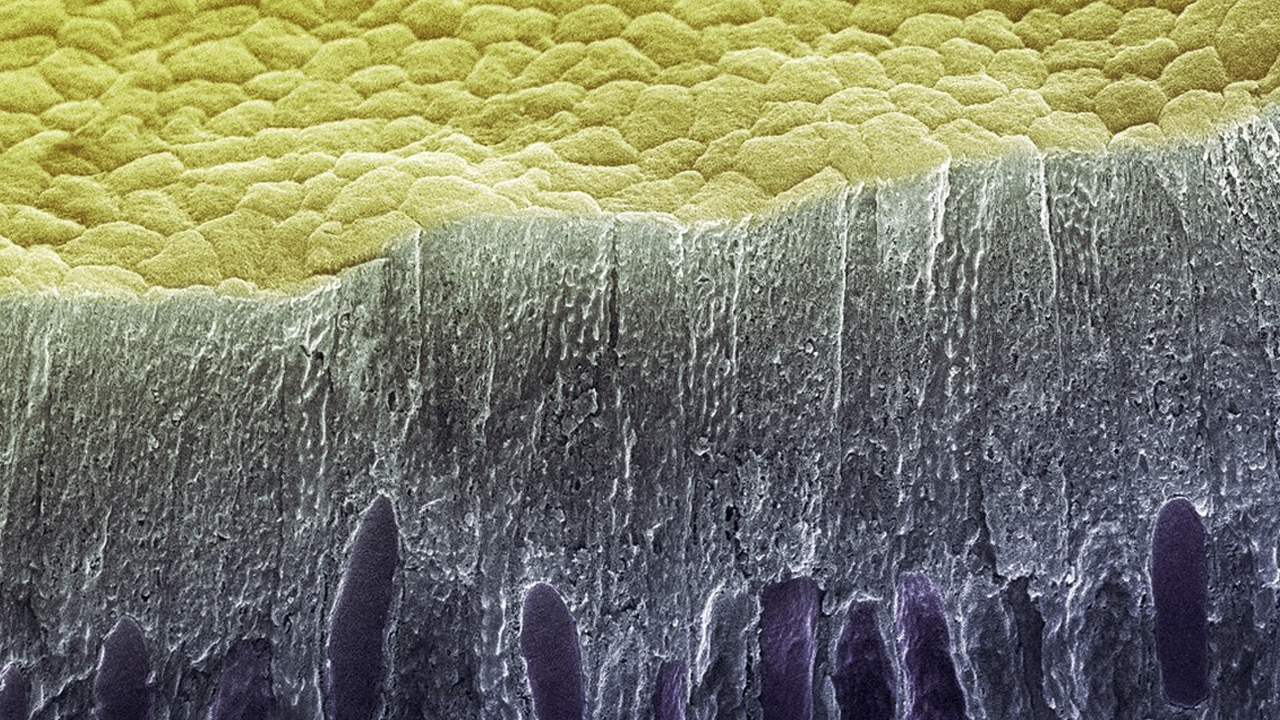 Под микроскопом фото грязь