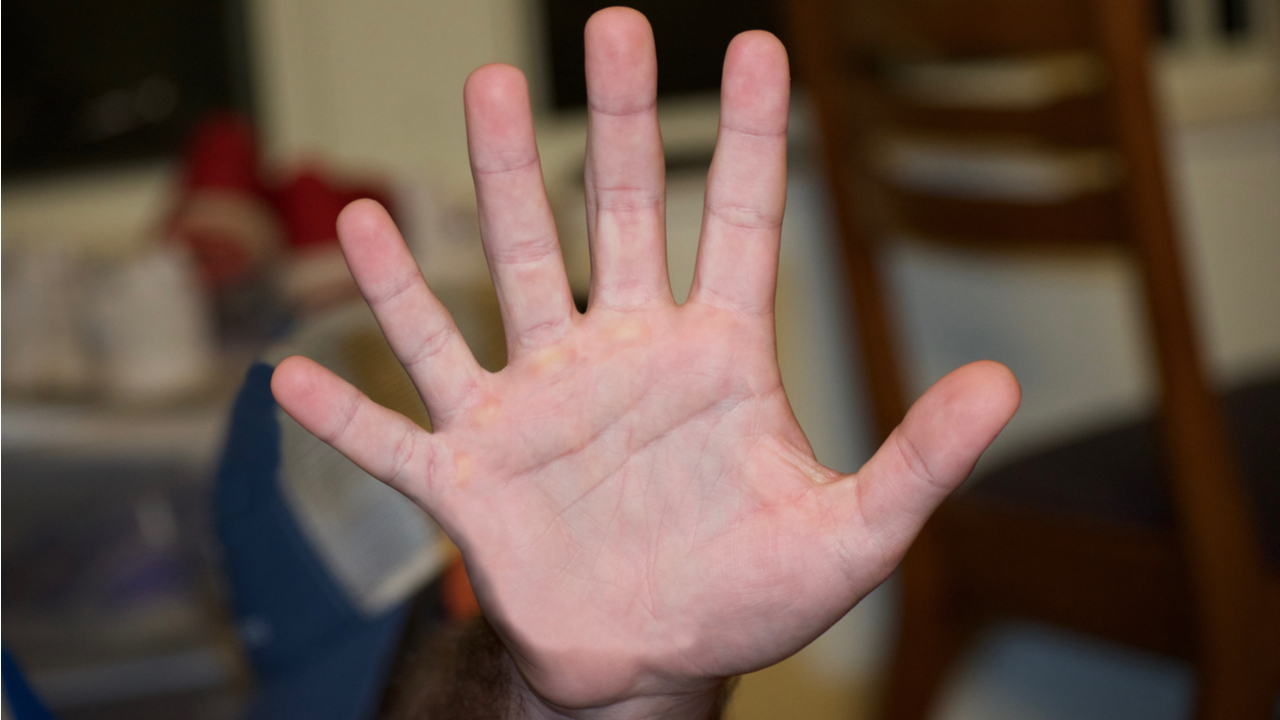 Три пальца на руке фото