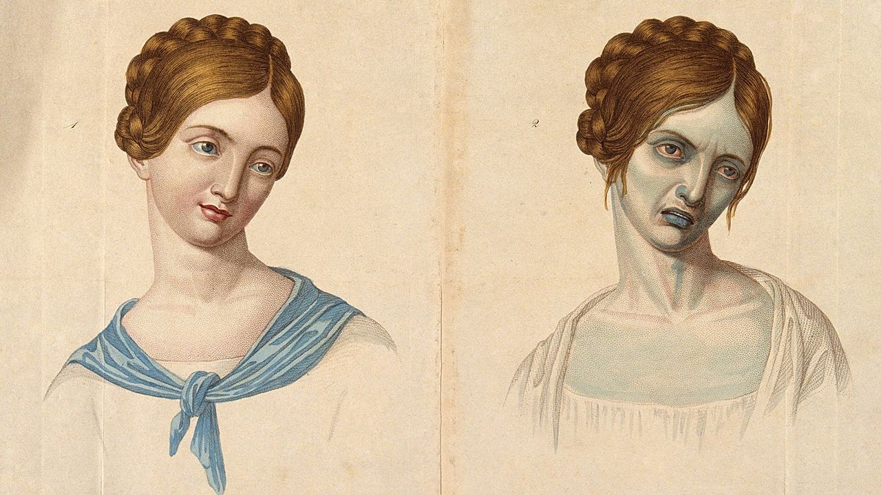 Холера 19 века иллюстрации