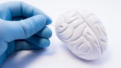 Пациент икал четыре месяца из-за опухоли головного мозга