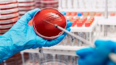 Новый анализ мочи предсказывает рак легких за несколько лет до симптомов