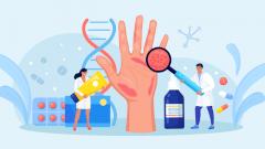 Ученые выявили неожиданный фактор, провоцирующий экзему