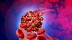 Названо самое распространенное осложнение после COVID-19