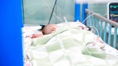 В Красногорске врачи спасли младенца с энцефалитом, развившимся из-за герпеса