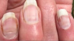 Ученый рассказал о новом симптоме коронавируса