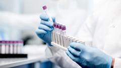 Вирусолог рассказал, возможна ли в России эпидемия сибирской язвы