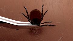 Атаковал клещ. Когда нужно обратиться к врачу