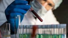 Биполярное расстройство и депрессию научились диагностировать по анализу крови