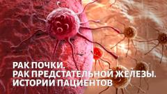 Рак почки и предстательной железы