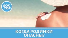 Родинки и меланома: когда нужно насторожиться