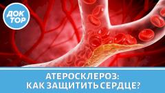 Атеросклероз: новые анализы и современные методы лечения
