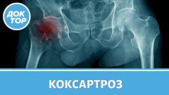 Правила против коксартроза