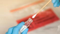 Роспотребнадзор запустил бесконтактное тестирование на COVID-19 по желанию