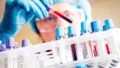 Тестирование москвичей показало, каковы шансы на коллективный иммунитет