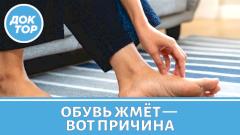 Отёки к вечеру: обувь жмёт, кольца врезаются — почему