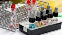 Ученые назвали наиболее уязвимую перед коронавирусом группу крови