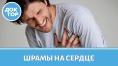 Как восстановиться после инфаркта