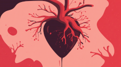 Гипертонический криз. Как распознать «тихий» инфаркт и оказать первую помощь