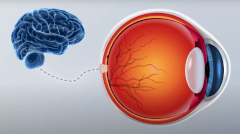 Бионический глаз