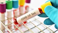 В России проведено более 20 000 000 тестов на коронавирус