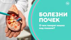 Болезни почек. Камни в почках, мешки под глазами, почечная недостаточность
