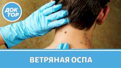 Ветрянка: переболеть или привиться