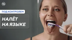 Какие продукты помогут справиться с налётом на языке