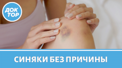 Синяки без причины: когда бить тревогу
