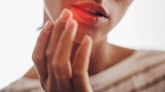 Что такое на самом деле «простуда на губах»