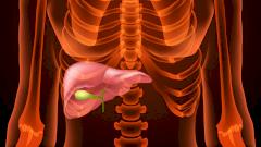 Пациенту восстановили желчные протоки с помощью катетера