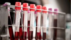 Создан тест с прогнозом течения COVID-19 и риска смерти