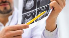 Синдром CKM: врачи выявили новую серьезную угрозу здоровью