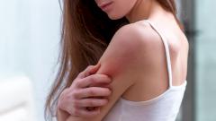 Найдены клетки кожи, которые способствуют возникновению псориаза и атопического дерматита