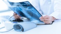 Изменения в пальцах рук и ног оказались признаком опасной болезни