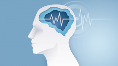 Инсульт: кто в группе риска и как защитить себя