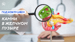 Когда необходимо удалять желчный пузырь