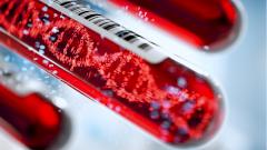 Новый препарат для лечения ВИЧ вырезает ДНК вируса из клеток