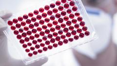 Москвичей массово проверят на антитела к коронавирусу