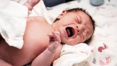 Девочка с волосатым хвостом родилась в Мексике