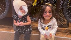 Девочке с «пятном Бэтмена» сняли повязку после операции