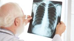 Кашель, ночной пот и другие симптомы: как определить туберкулез