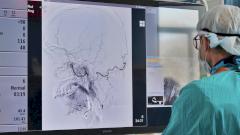 В Тюмени мужчине сделали новый язык