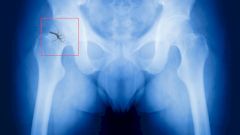 Назван ещё один риск для курильщиков