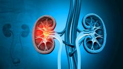 В Подмосковье хирурги достали из почки мужчины камень-коралл