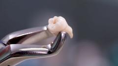 Врачи нашли у американца выросший в носу зуб