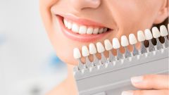 Стоматологи рассказали, где делать отбеливание зубов и кому оно требуется