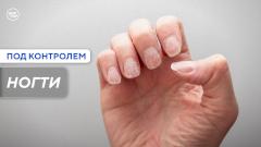 Как по ногтям заподозрить проблемы с сердцем или печенью