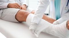 перелом, курение, мужчина