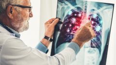 Ученые выяснили причину дефицита кислорода в крови при COVID-19